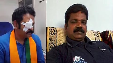 எதிர்க்கட்சிகள் தாக்கியதாக நாடகமாடிய பாஜக வேட்பாளர் : இறுதியில் காத்திருந்த அதிர்ச்சி... நடந்தது என்ன ? 