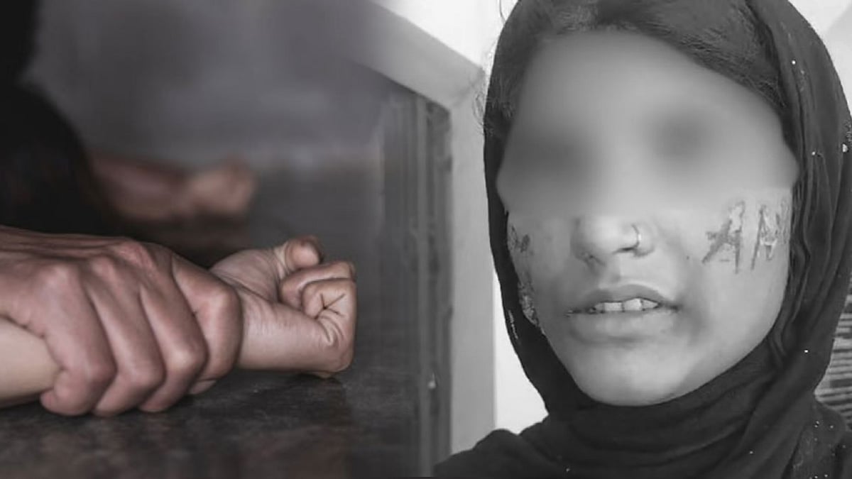 திருமணத்துக்கு மறுப்பு : 3 நாட்கள் வன்கொடுமை செய்து சூடு போட்ட இளைஞர்-பாஜக ஆளும் உ.பி-யில் தொடரும் அவலம்!