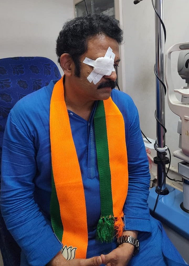 எதிர்க்கட்சிகள் தாக்கியதாக நாடகமாடிய பாஜக வேட்பாளர் : இறுதியில் காத்திருந்த அதிர்ச்சி... நடந்தது என்ன ? 