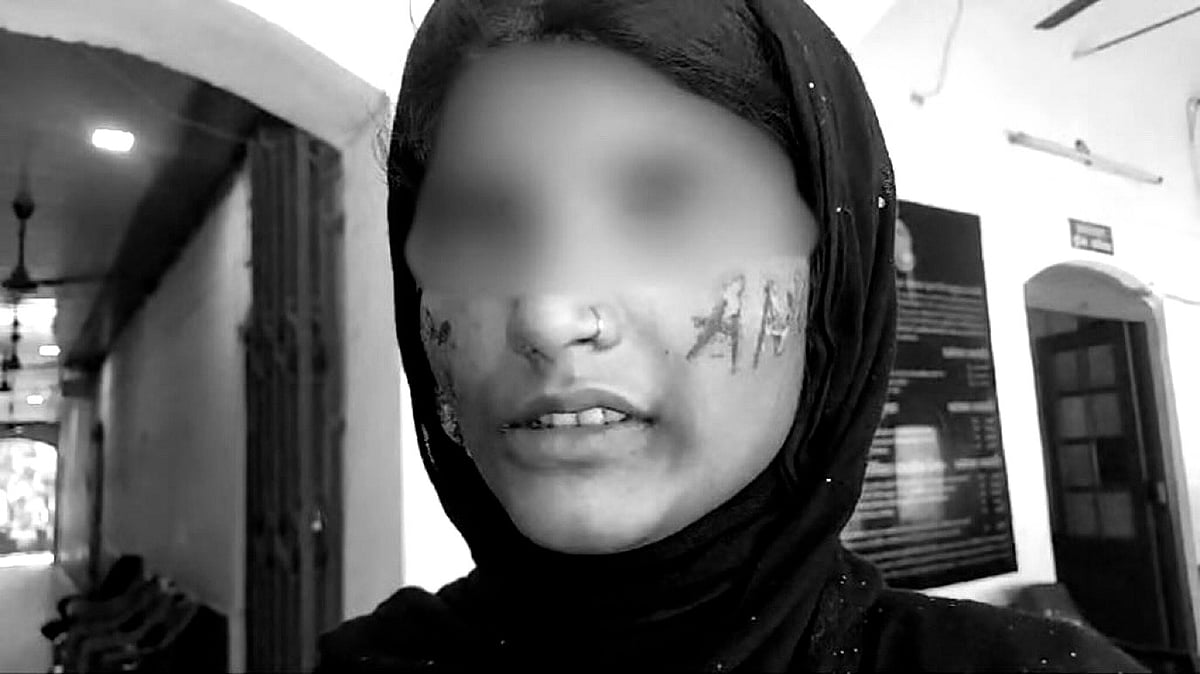 திருமணத்துக்கு மறுப்பு : 3 நாட்கள் வன்கொடுமை செய்து சூடு போட்ட இளைஞர்-பாஜக ஆளும் உ.பி-யில் தொடரும் அவலம்!