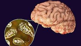 மூக்கு வலியாக மூளைக்கு செல்லும் அமீபா : முன்னெச்சரிக்கை நடவடிக்கை மேற்கொள்ள சுகாதாரத்துறை அறிவுறுத்தல் !