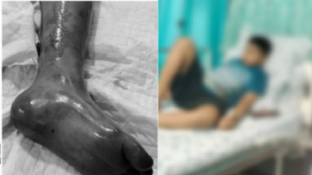 சிறுவனுக்கு தவறான சிகிச்சை அளித்த தனியார் மருத்துவமனை... அதிரடி நடவடிக்கை எடுத்த அதிகாரிகள் !