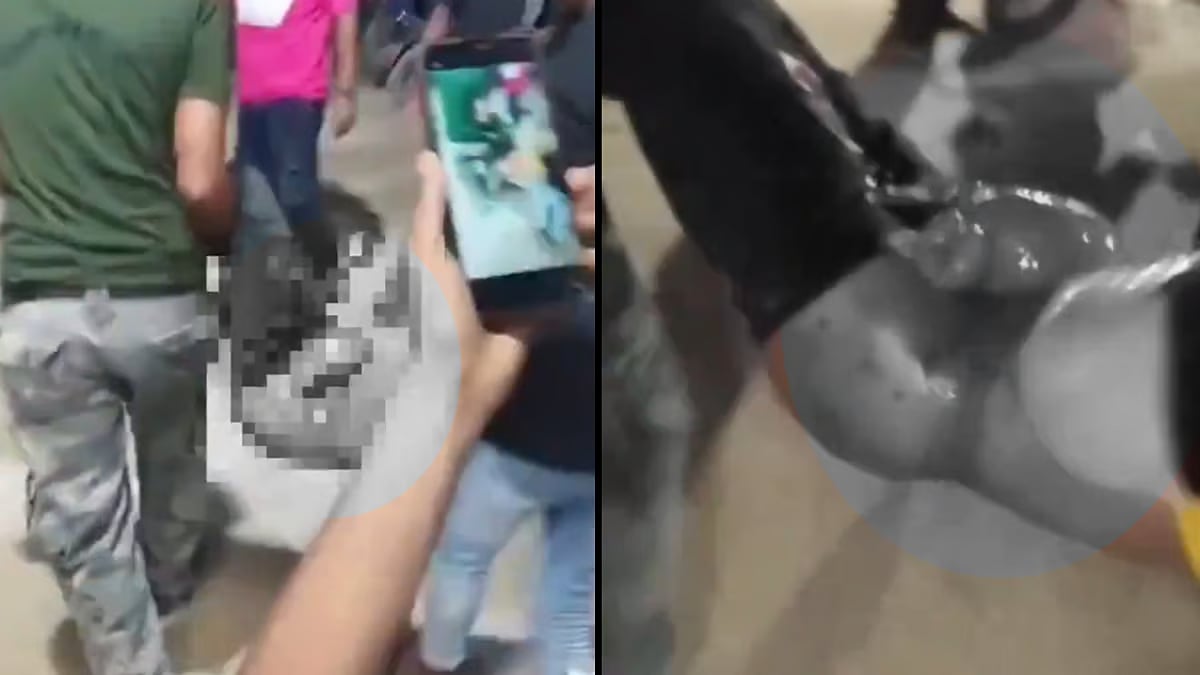 பீகாரில் இளைஞரை போலீசார் கடுமையாக தாக்கியதில், அவரது குடல் வெளியே வந்த சம்பவம்