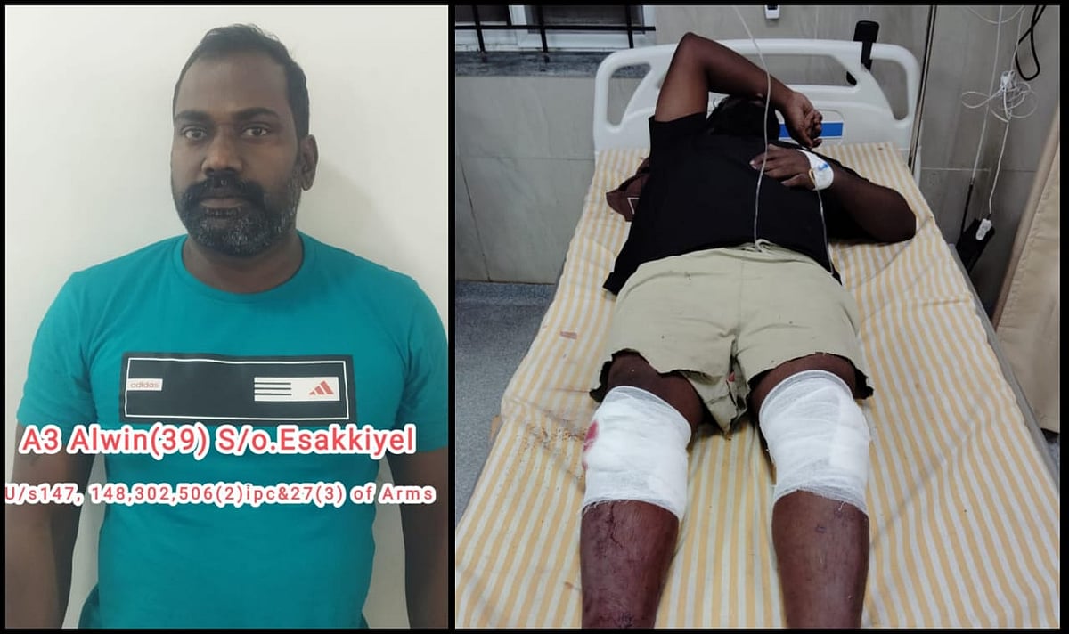 போலீசாரை தாக்கி தப்ப முயன்ற ரவுடி முழங்காலுக்கு கீழ் சுடப்பட்டு கைது : கோவையில் போலீசார் அதிரடி !