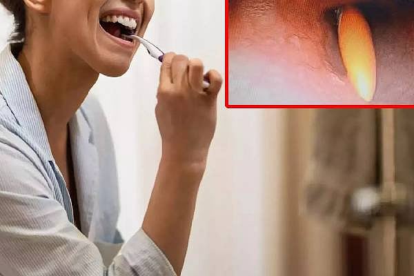 தெரியாமல் 20 செ.மீ. Tooth Brush-ஐ விழுங்கிய பெண்... ஷாக்கான மருத்துவர்கள்... பிறகு நடந்தது என்ன?