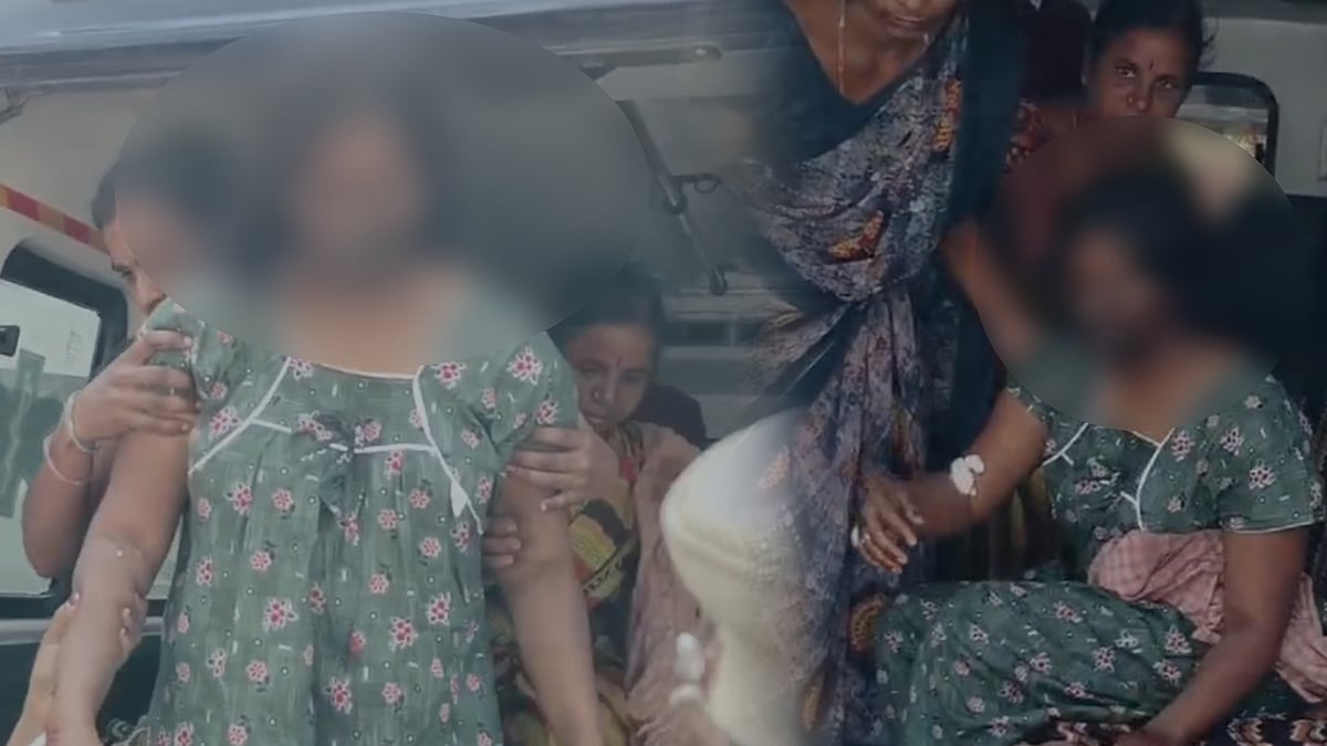 காதலர் தினத்தன்று கொடூரம்: காதலி முகத்தில் ஆசிட் வீசி தாக்குதல் நடத்திய காதலன்... ஆந்திராவில் அதிர்ச்சி !