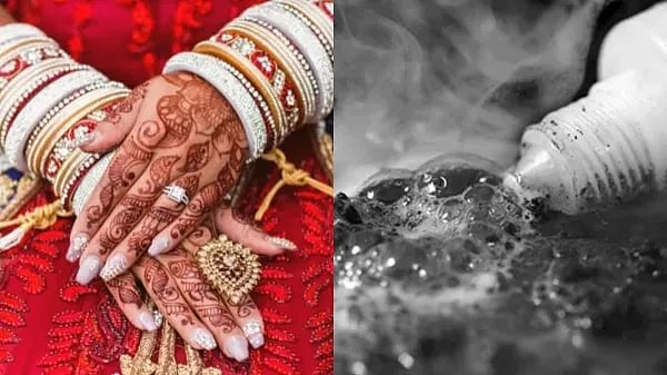 திருமணம் நிச்சயத்தால் ஆத்திரம்.. இளம்பெண் மீது ஆசிட் வீசிய 4 குழந்தைகளின் தந்தை... உ.பி-யில் பயங்கரம்!