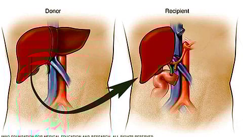 	கல்லீரல் தானம்