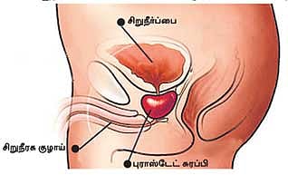 ஆண்களே உஷார்! உஷார்......!