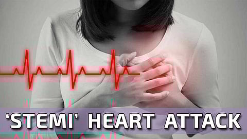 ஸ்டெமி ரக ஹார்ட் அட்டாக் - ஆண்களை விட பெண்களுக்கு ஆபத்து அதிகம்! மெட்ராஸ் மெடிக்கல் கல்லூரியின் ஆய்வறிக்கை சொல்லும் செய்தி!