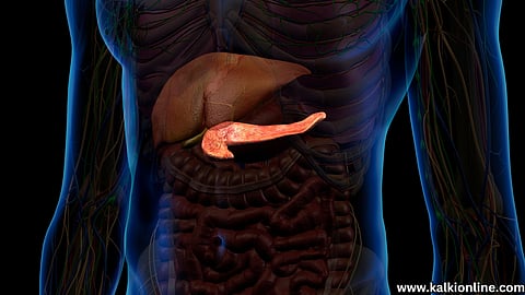 Excess Bile in the body.