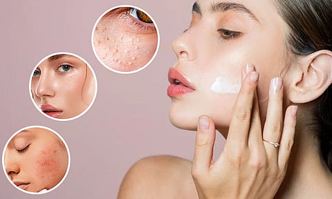 சரும வறட்சி