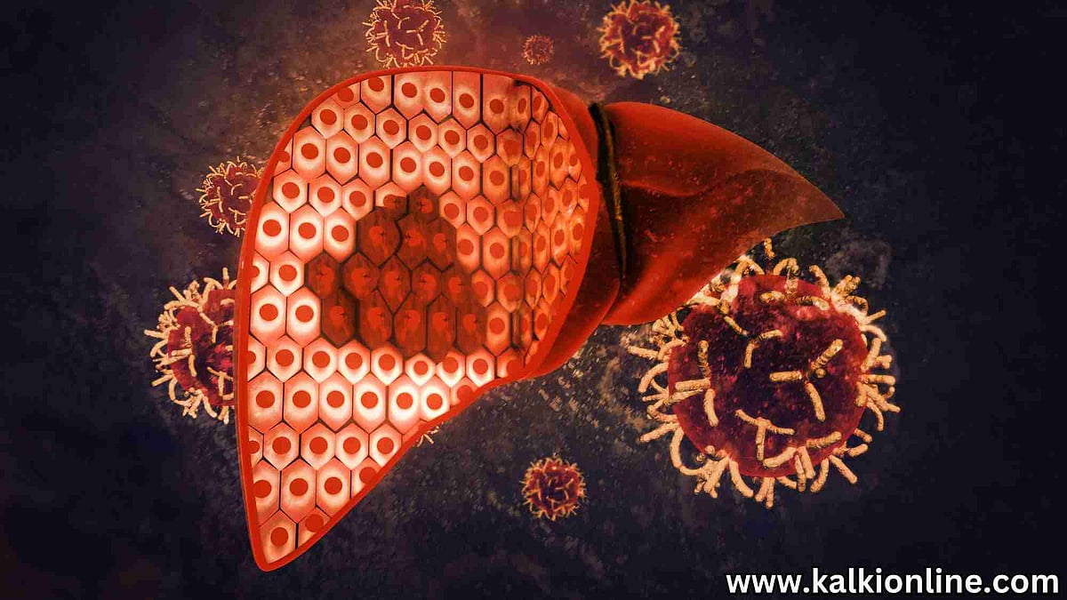 Jika Anda mengalami gejala-gejala ini, berhati-hatilah! Mengenali gejala perlemakan hati Jika Anda mengalami gejala-gejala ini, berhati-hatilah! Mengenali gejala perlemakan hati