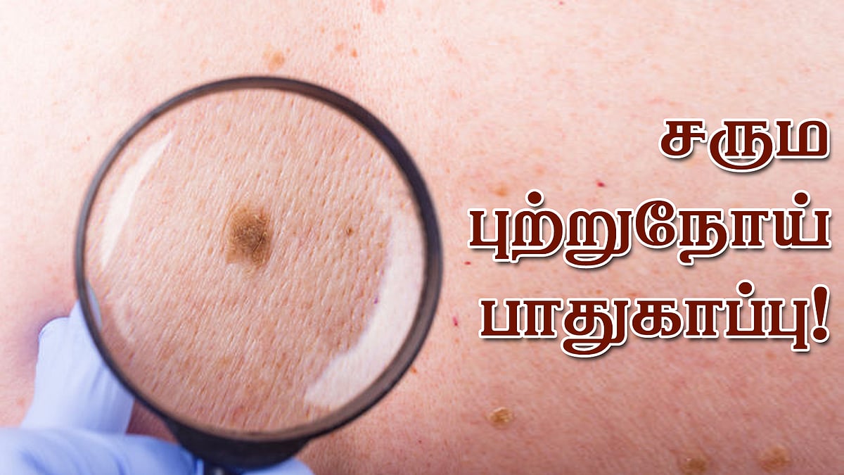 அதிகரிக்கும் வெப்பம்! சருமப் புற்றுநோய்க்கான அபாயம்!சரும பாதுகாப்பு மருத்துவர்கள் கூறுவது என்ன?