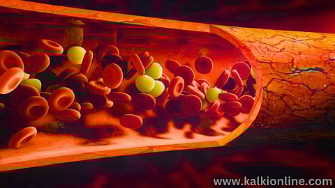 blood flow