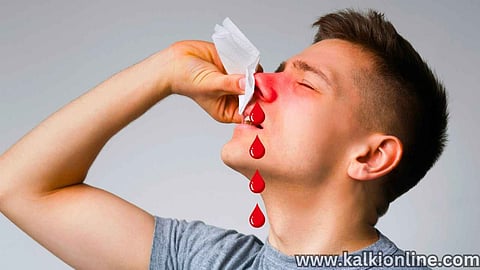 nosebleed