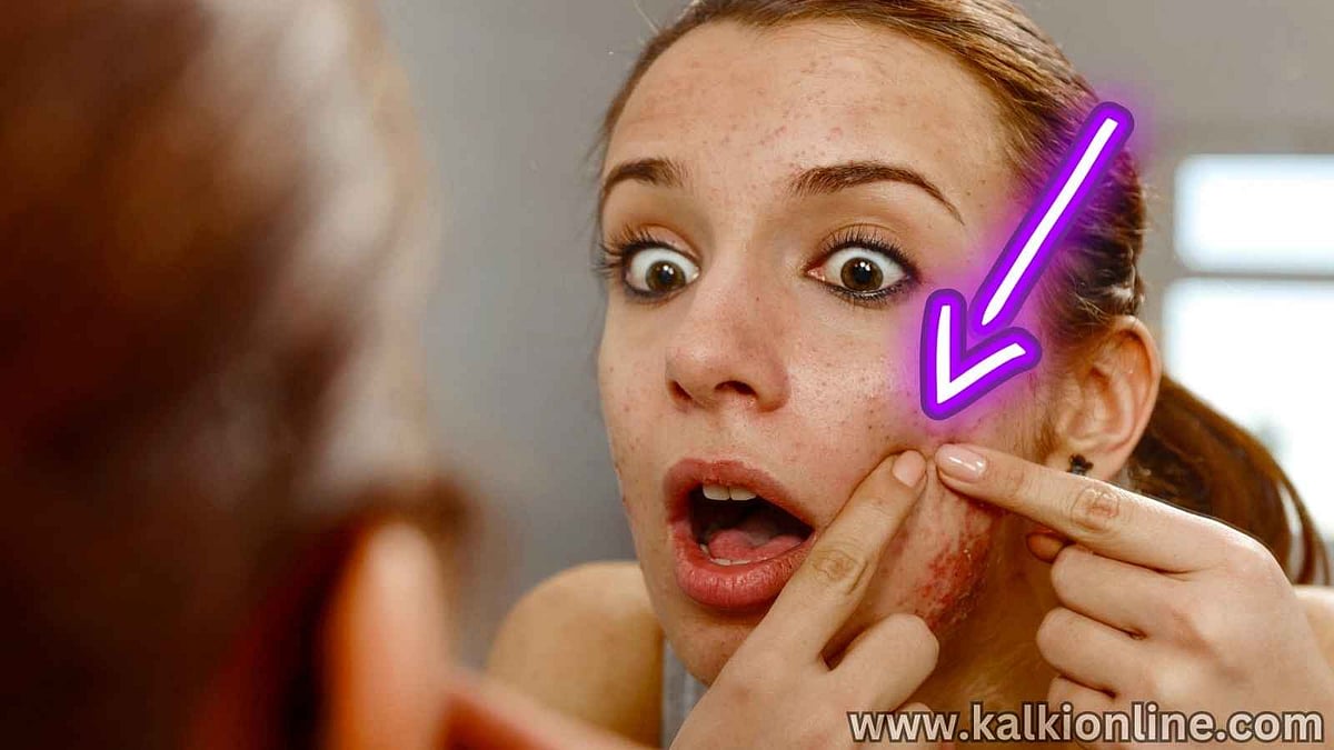 என்ன செய்தாலும் முகப்பருக்கள் மீண்டும் வரும்... ஆய்வில் வெளிவந்த உண்மை! 