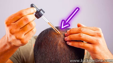 Minoxidil