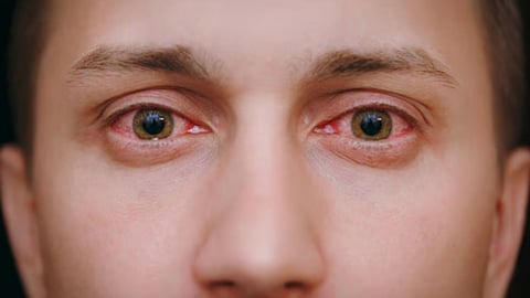 Body symptoms and solutions