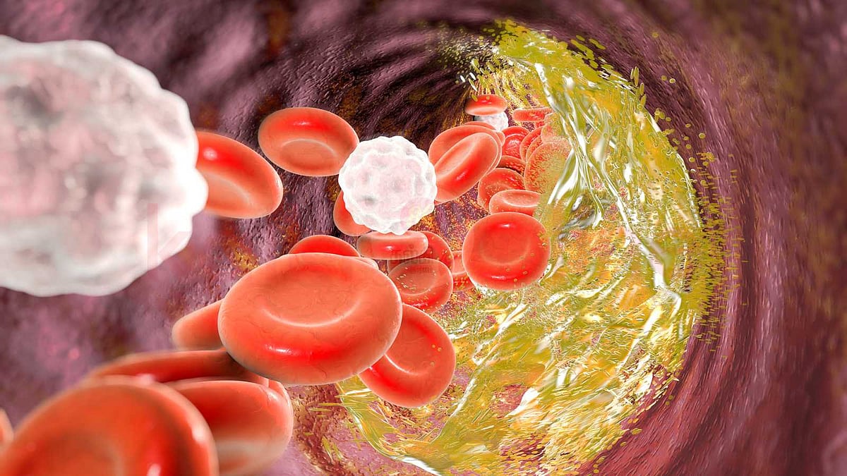 உடல் நலம் பேண காலையில் தவிர்க்க வேண்டிய 4 வகை உணவுகள்!