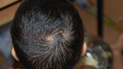 Head Suzhi