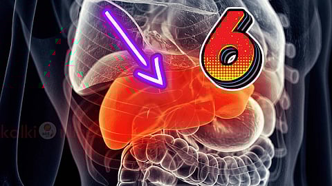 Fatty Liver 