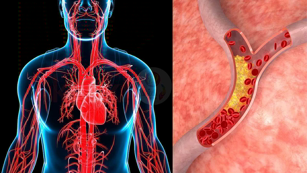 இதயத் தமனிகளை ஆரோக்கியமாக வைத்திருக்க உதவும் 5 முக்கியமான வைட்டமின்கள்!