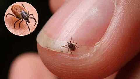 Scrub typhus