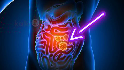 Gut