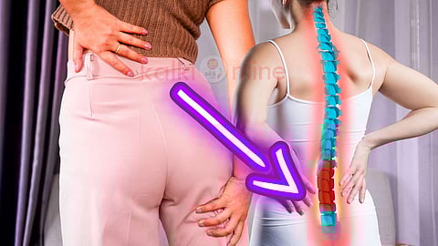 Sciatica