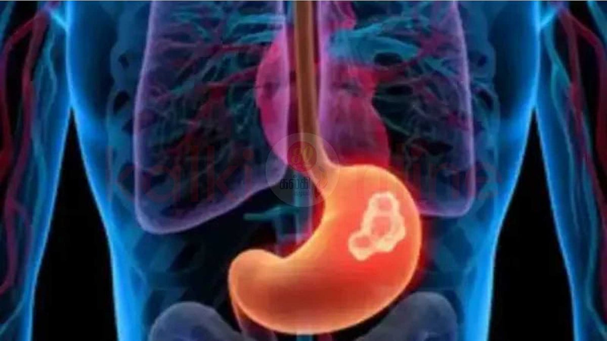 வயிற்றில் கட்டி இருப்பதை உணர்த்தும் 5 அறிகுறிகள்!