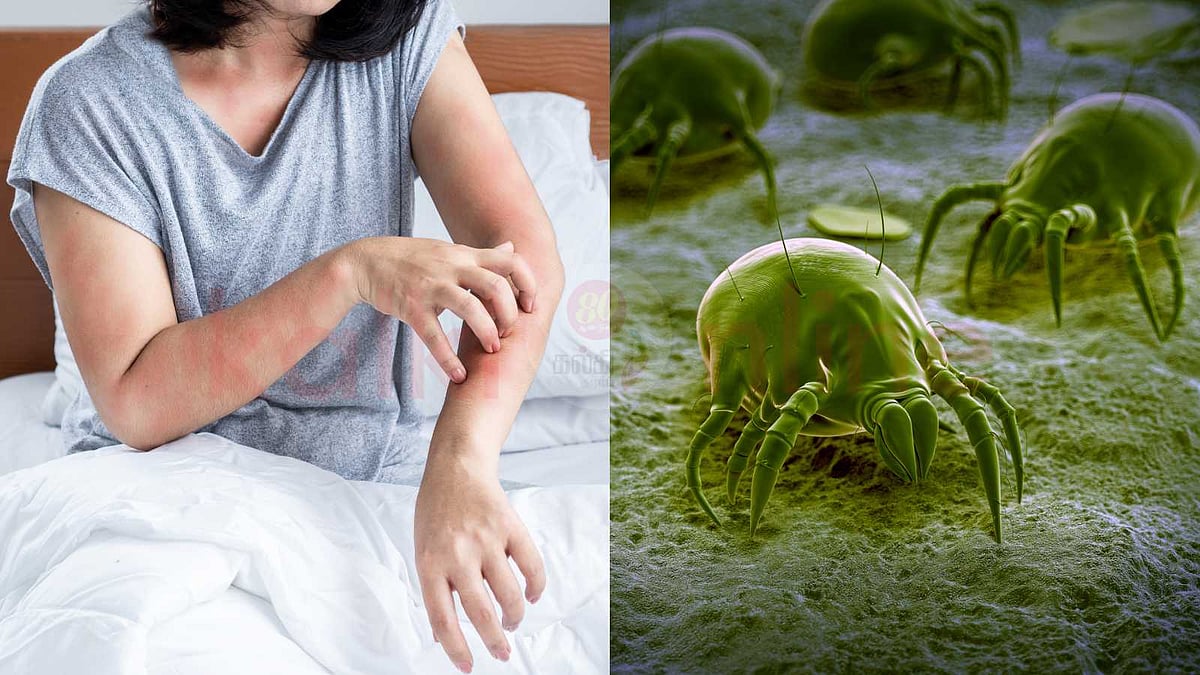 மனிதர்களிடம் ஒவ்வாமையை ஏற்படுத்தும் மைட் பூச்சிகள்!