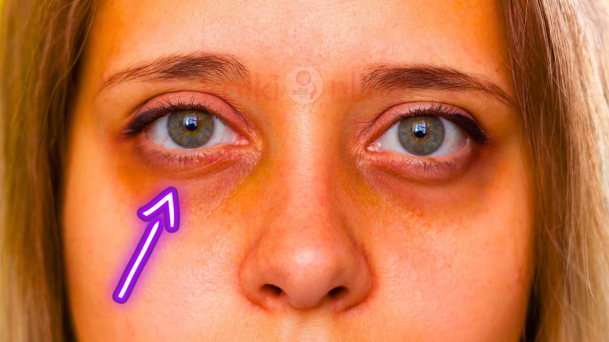 கருவளையங்களை விரைவில் சரி செய்யும் அற்புத கிரீம்! 