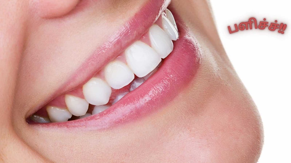 பற்களில் படியும் வெண் படலம் - கறைகள் நீங்கி பற்கள் பளிச்சிட... 