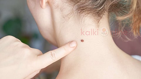 Mole