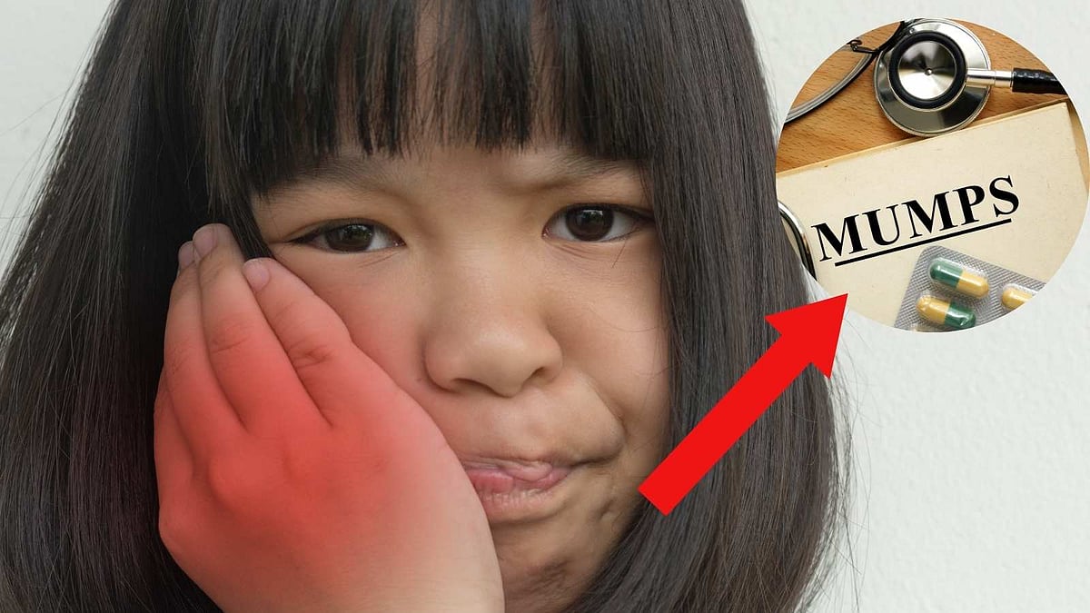 ஒரே பள்ளியில் 21 மாணவர்களுக்கு பொன்னுக்கு வீங்கி பாதிப்பு!