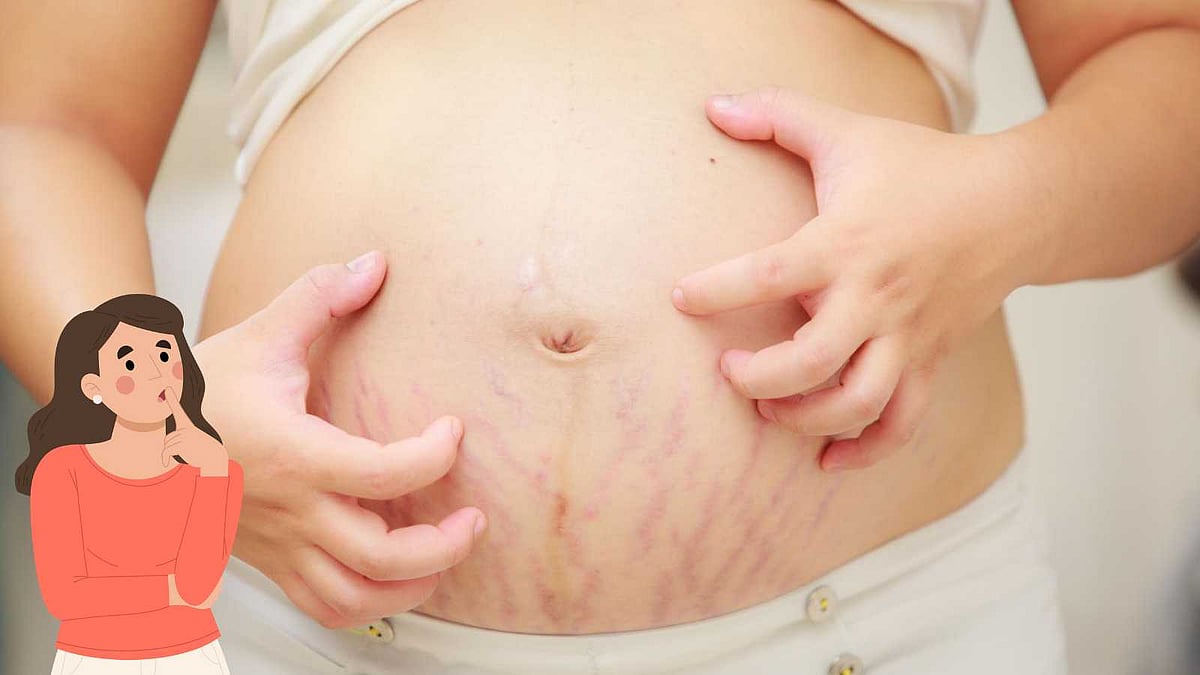 கர்ப்ப காலத்தில் வயிறு மற்றும் இடுப்பை சுற்றி அரிப்பு ஏற்படுவதன் காரணம் என்ன தெரியுமா? 