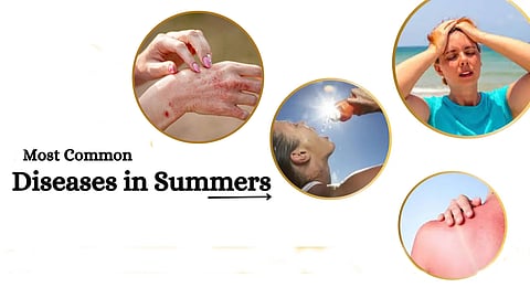 Common summer infections