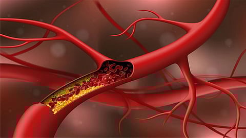 Blood cholesterol 