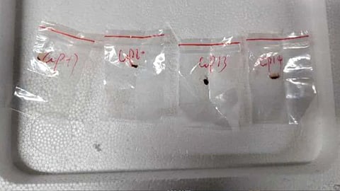 Biological Pathogen