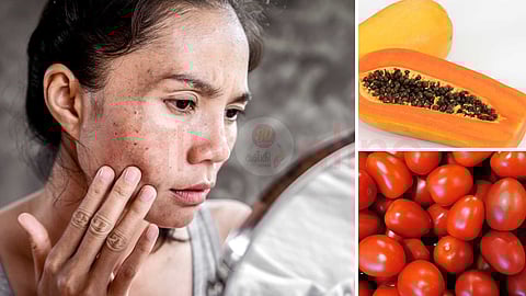 Tips for dark dots