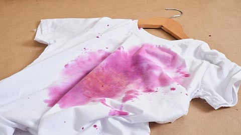 Dress dye stuck