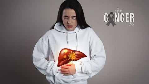 Hepatitis D