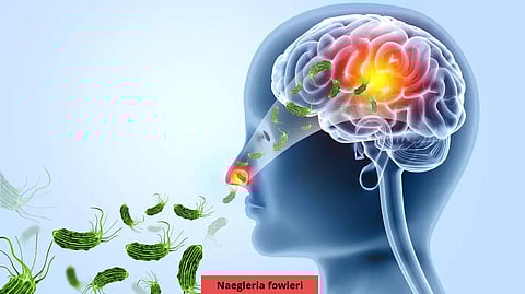 Brain Eating Amoeba