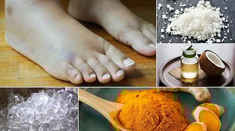 Swollen feet and remedies