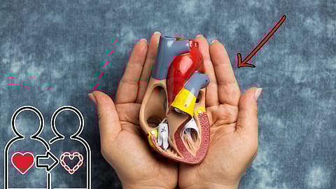 Organ transplant