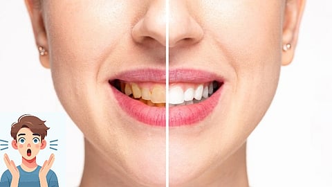 yellow to white teeth
