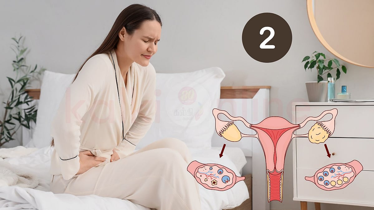 அன்றாட வாழ்வில் ஆரோக்கியம் 2: பயம் காட்டும் நீர்க்கட்டி! 'கன்னி முலிகை' மிகச் சிறந்த மருந்து! 