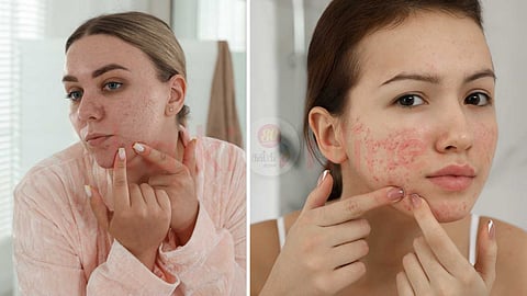 Beauty tips