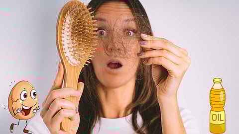 Hairfall